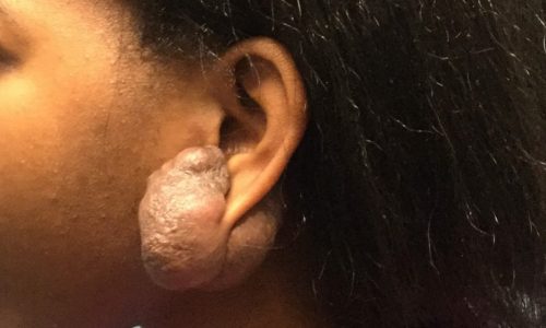 Patient_Image 01_24_20 14_07_41