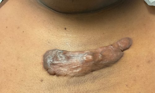 Patient_Image 10_29_21 13_56_50